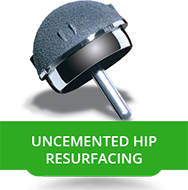 Uncemented Hip Resurfacing